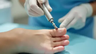 jak vydloubnout kuří oko video návod – Účinné metody pro odstranění kuřího oka