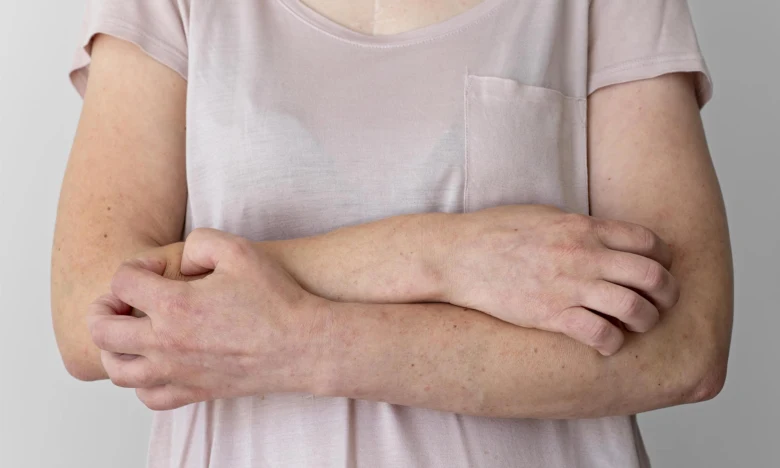 Osoba s červenými skvrnami na pažích, svědění kůže bez vyrážky