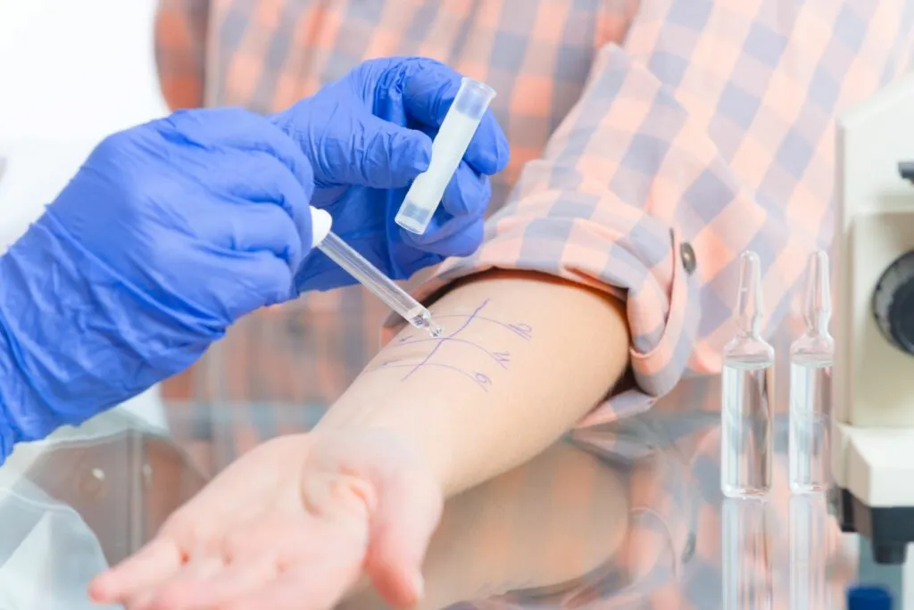Test alergie na kůži, lékař s nástroji