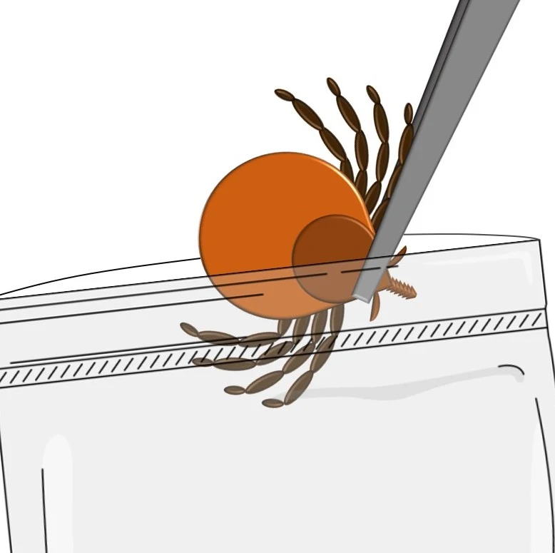 Ilustrace správného vyjmutí klíště kleštěmi