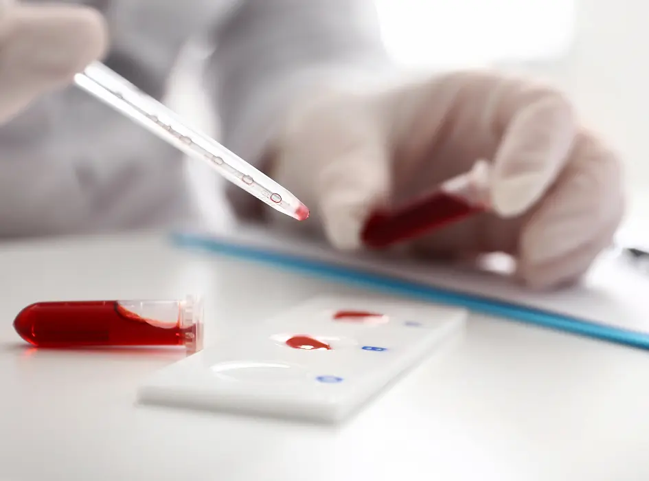 Krevní vzorek se přenášejí na diagnostickou desku.
